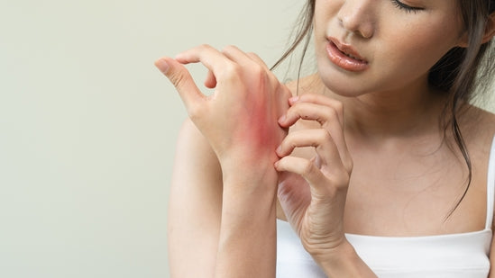 Il Sole e la Dermatite Atopica: Benefici e Rischi